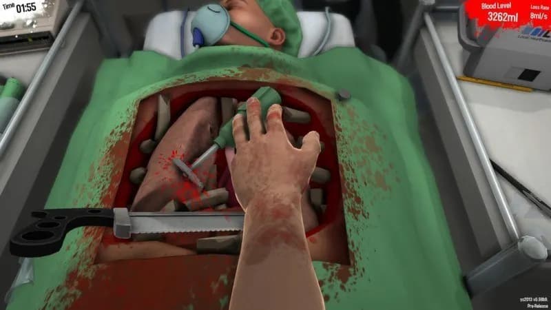 SURGEON SIMULATOR ANNIVERSARY EDITION Steam — zrzut ekranu 4